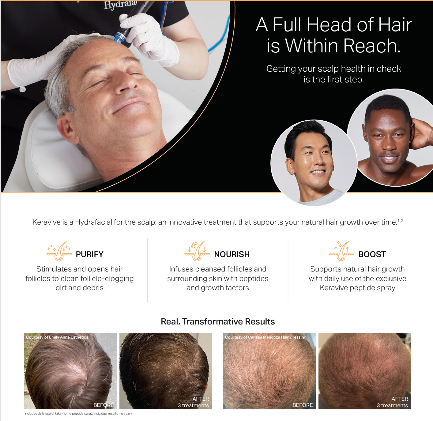 scalp cleanse